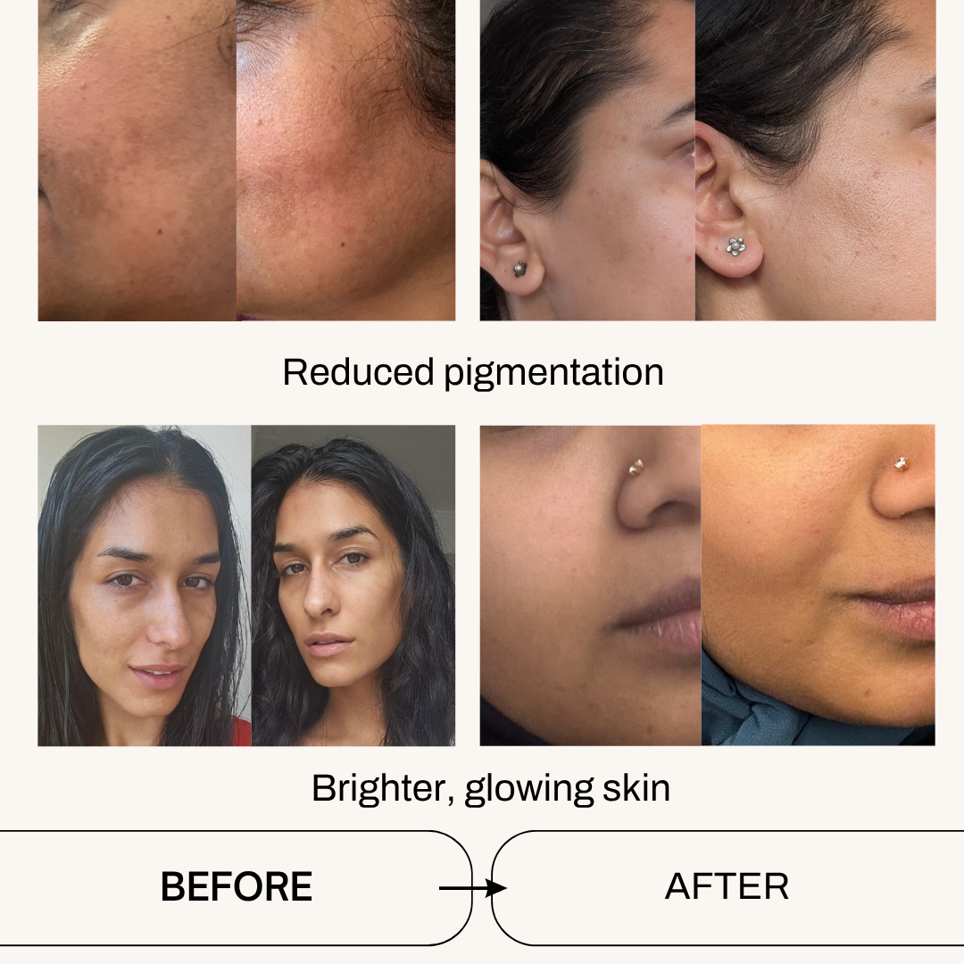 Nourishing Face Oil - best for pigmentation and dry skin