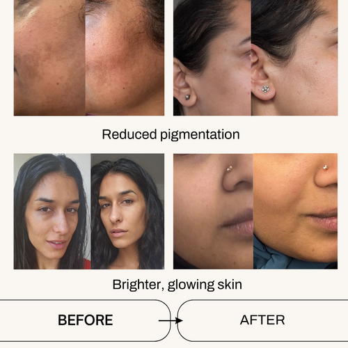 Nourishing Face Oil - best for pigmentation and dry skin